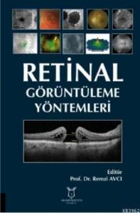 Retinal Görüntüleme Yöntemleri