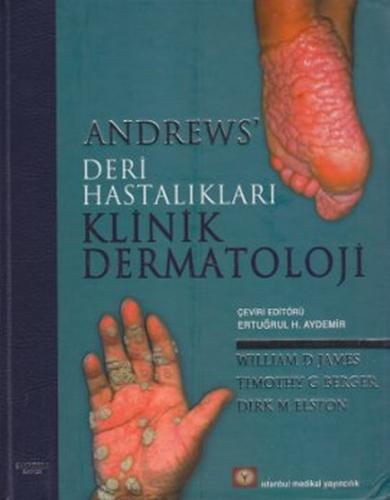 Andrew's Deri Hastalıkları Klinik Dermatoloji Kollektif