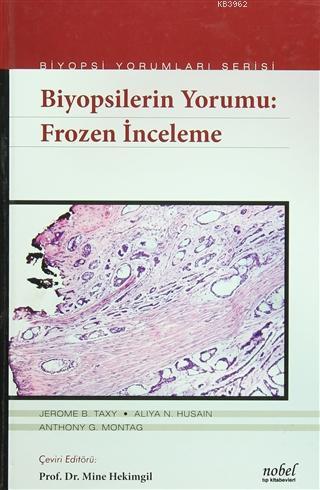 Biyopsilerin Yorumu: Frozen İnceleme Jerome B. Taxy