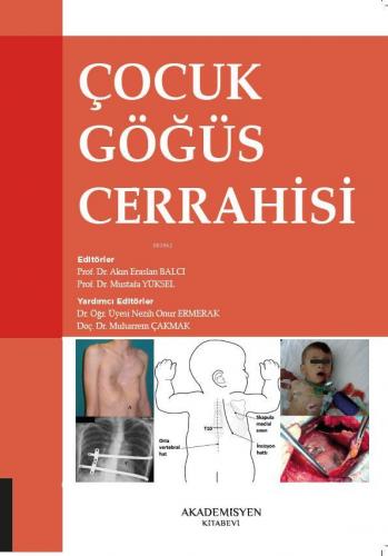 Çocuk Göğüs Cerrahisi