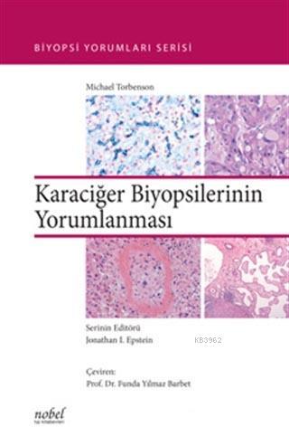 Karaciğer Biyopsilerinin Yorumlanması