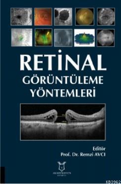 Retinal Görüntüleme Yöntemleri